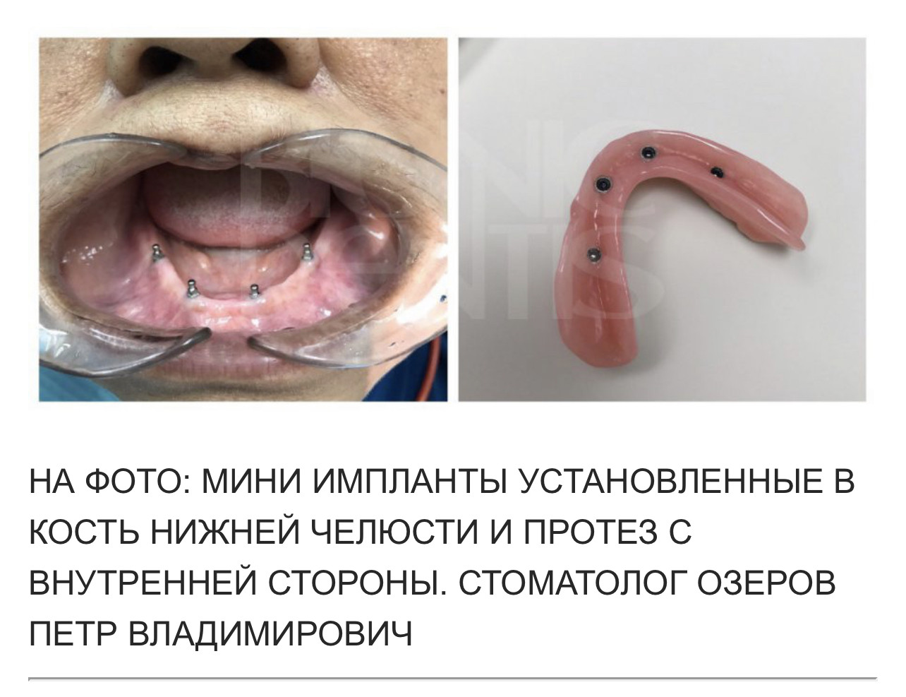 Forum_Topic