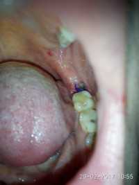 Forum_Topic
